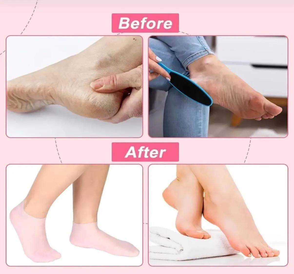 Silikon Krem Çorabı *360